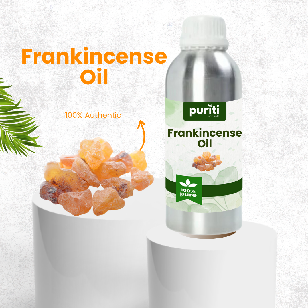 Frankincense Essential Oil